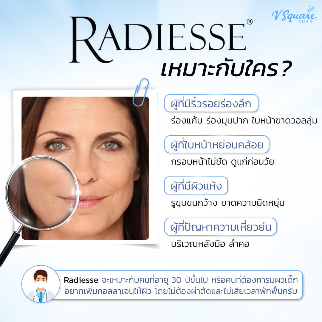 Radiesse filler เหมาะกับใคร