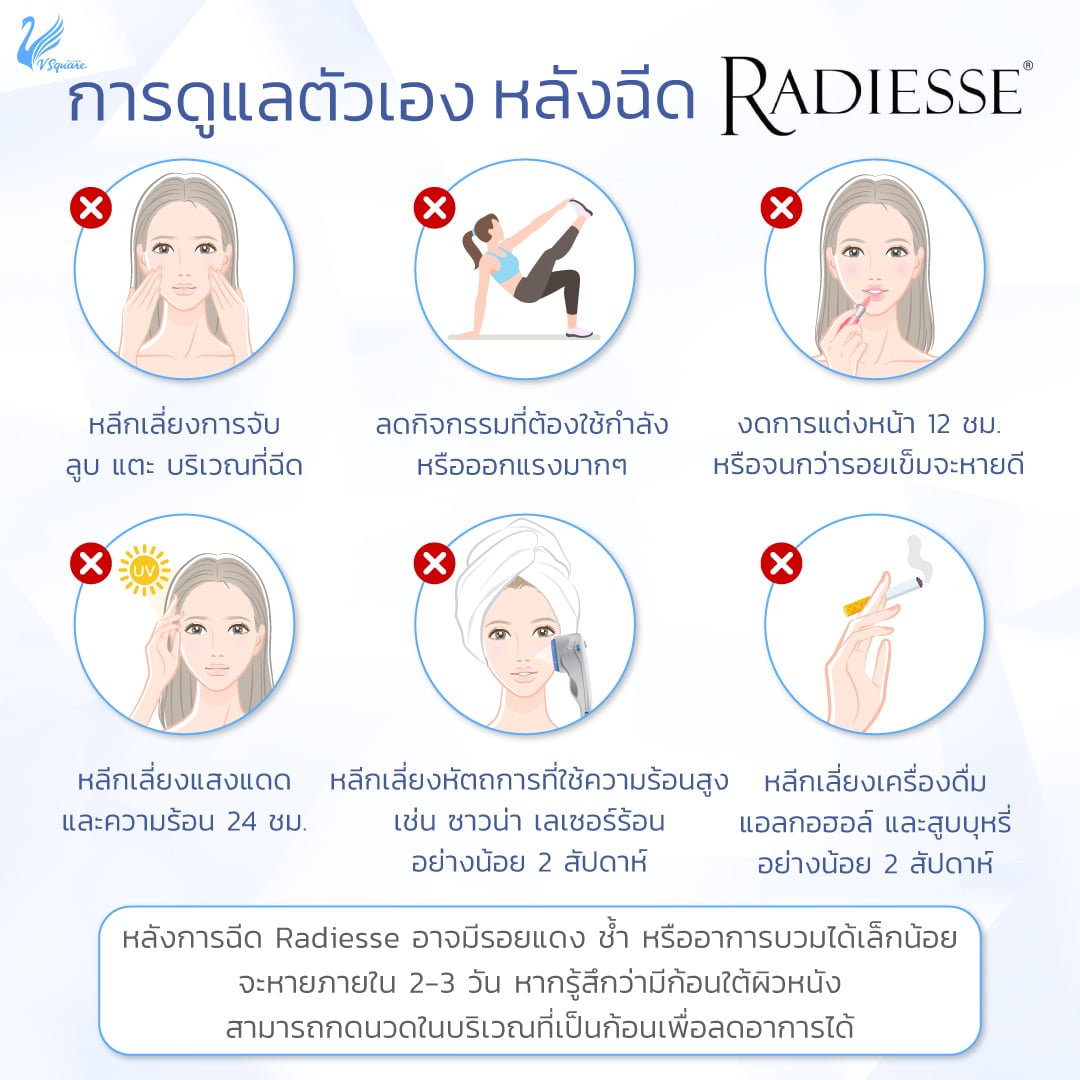 การดูแลตัวเองหลังฉีด Radiesse