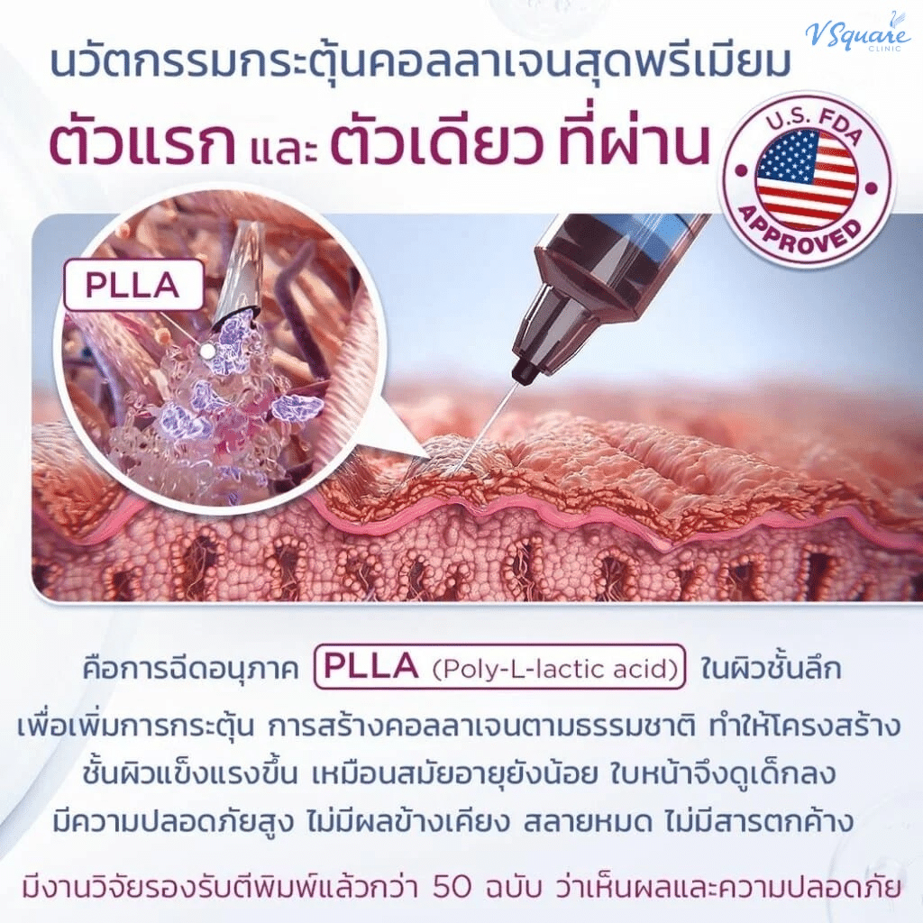 Sculptra นวัตกรรมกระตุ้นคอลลาเจน