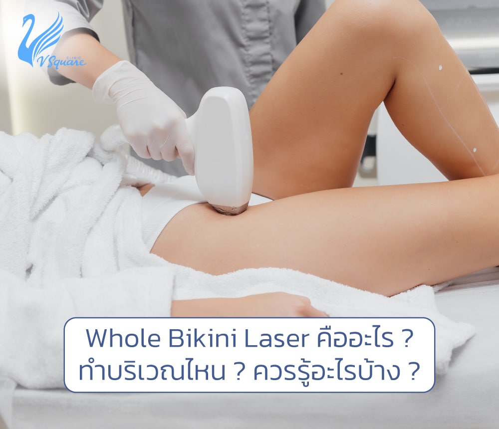Whole-Bikini-Laser-คืออะไร