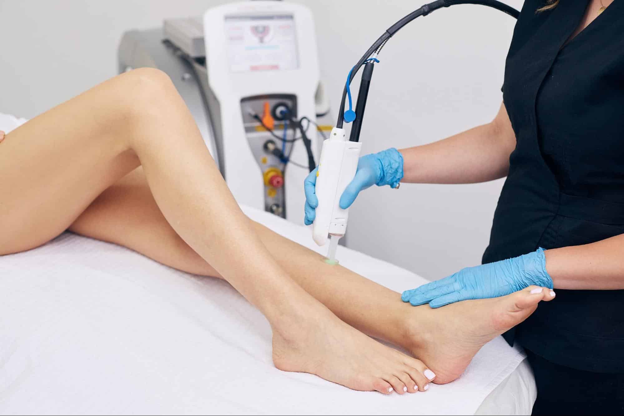 YAG laser กำจัดขน