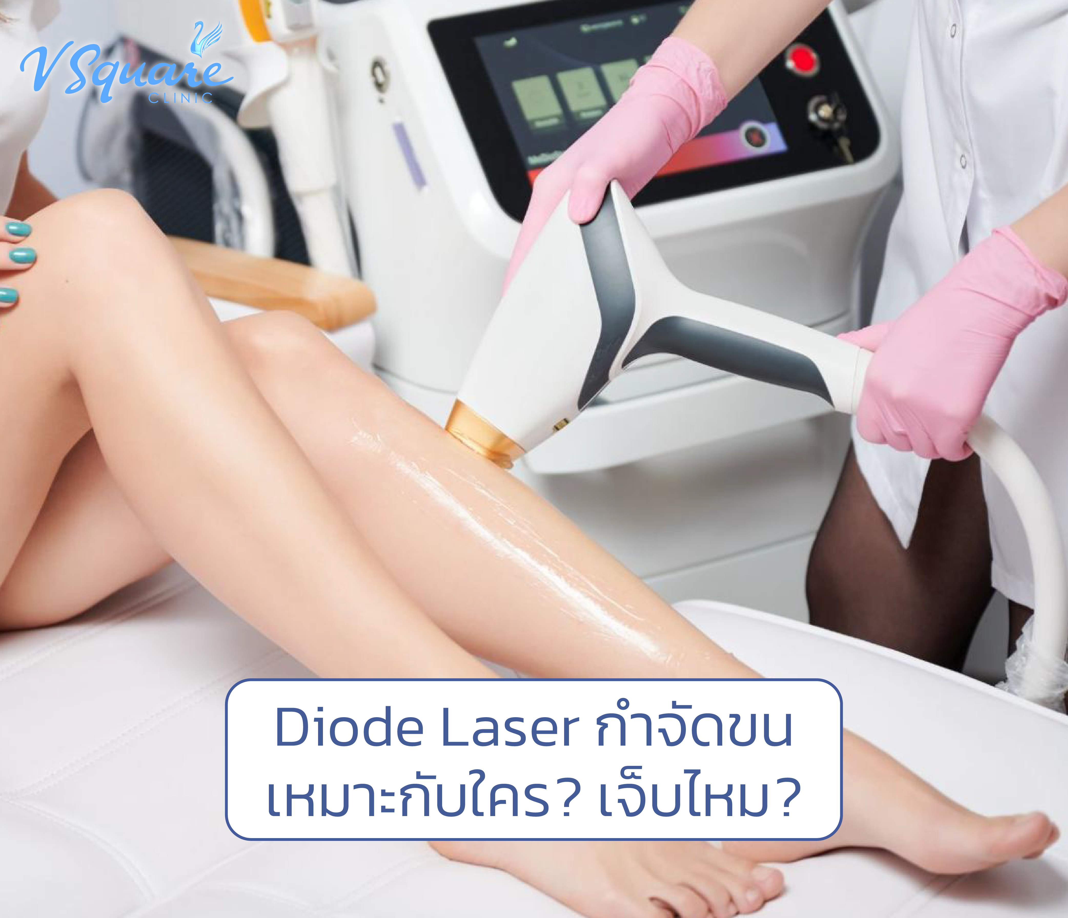 diode laser