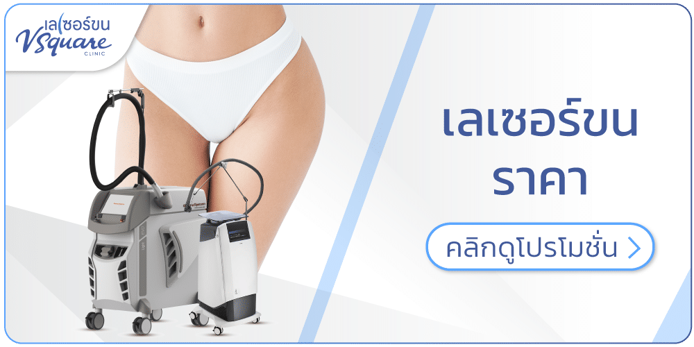 เลเซอร์ขนราคา