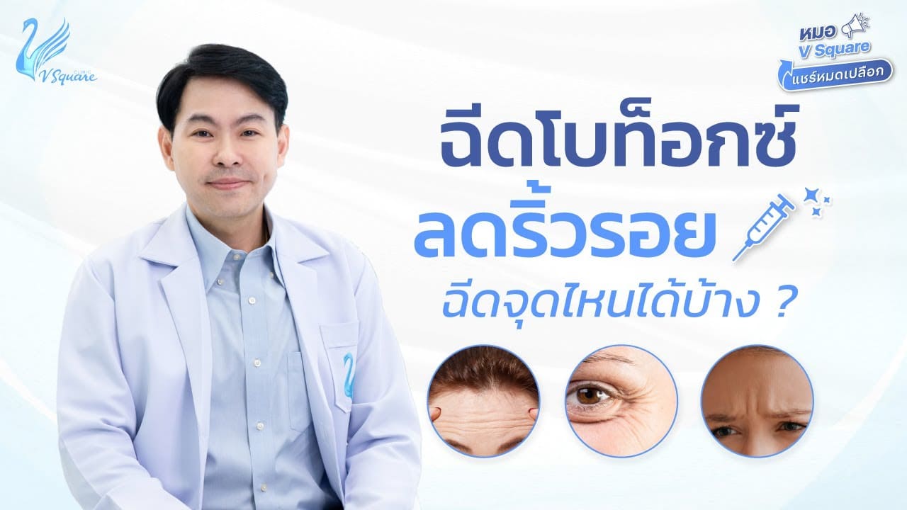 ฉีดโบท็อกลดริ้วรอ-by-หมอเบิร์ด