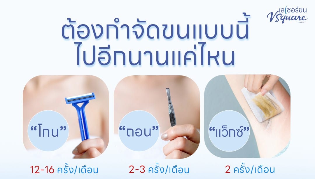 กำจัดขนแบบชั่วคราว