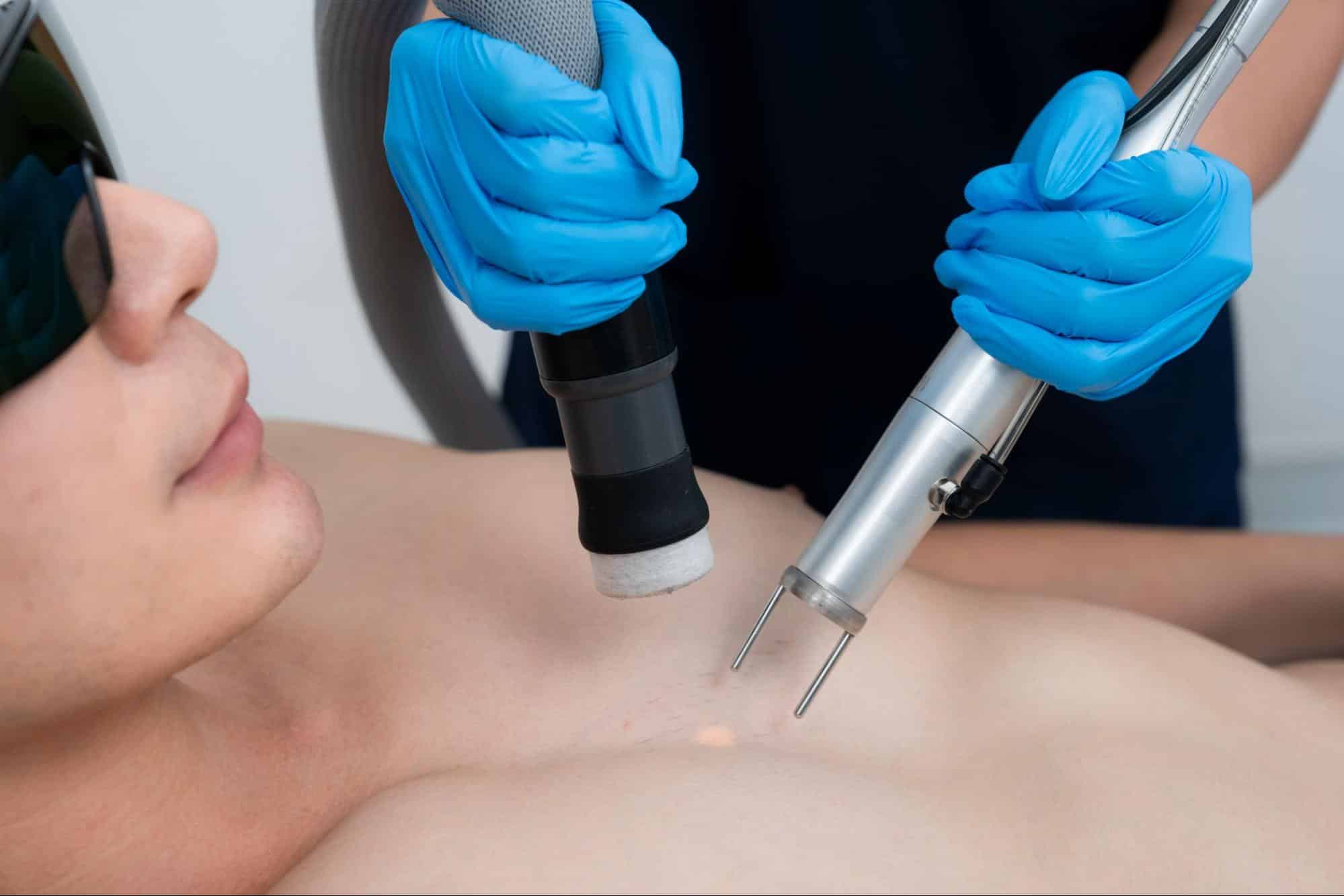 ขั้นตอนการเลเซอร์ขนหน้าอก