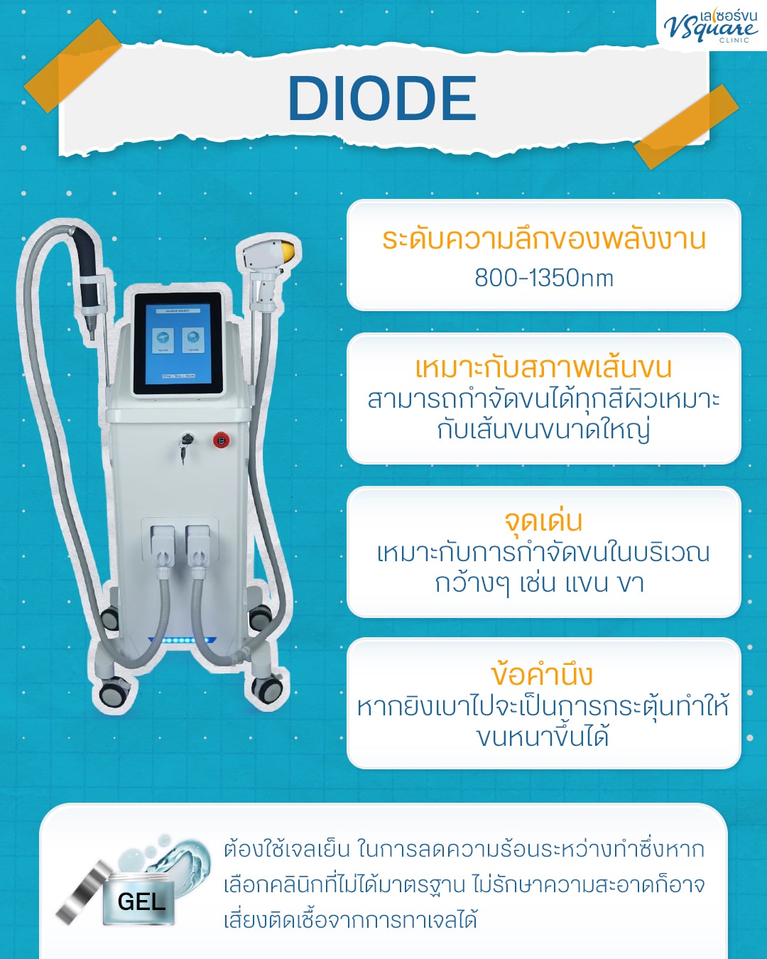 เลเซอร์ขนด้วย Diode Laser
