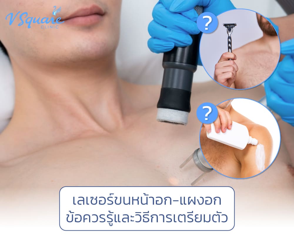 เลเซอร์ขนหน้าอก