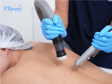 เลเซอร์ขนหลัง 370x277