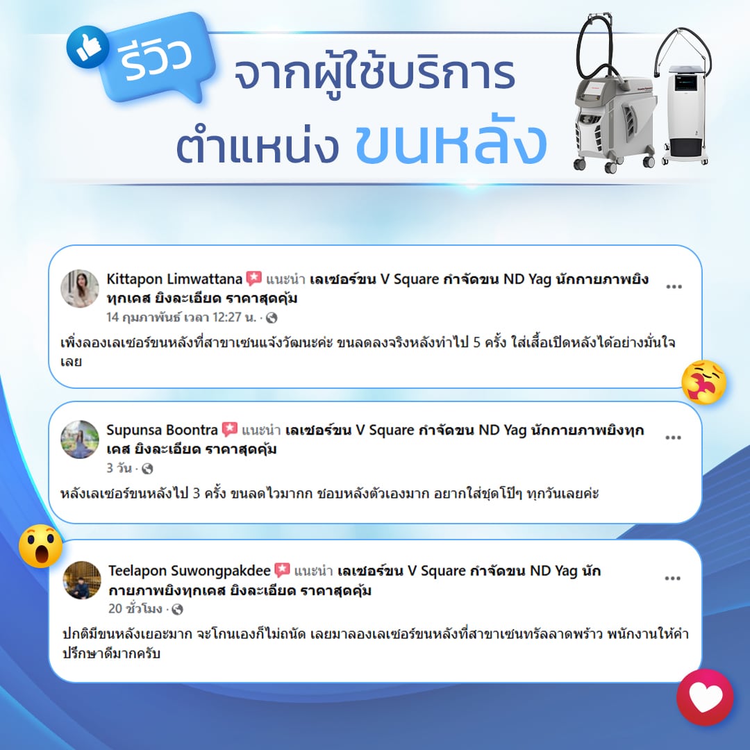 เลเซอร์ขนหลัง รีวิว