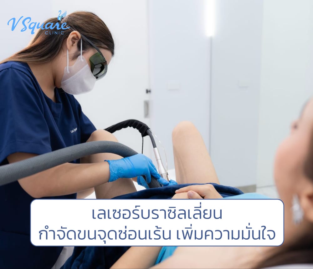 เลเซอร์บราซิลเลี่ยน