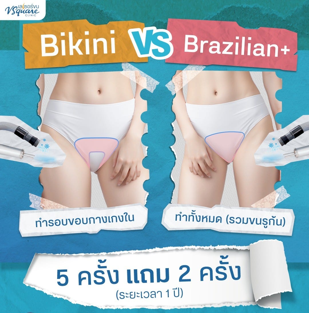 เลเซอร์บราซิลเลี่ยน กับ เลเซอร์บิกินี่ ต่างกันยังไง