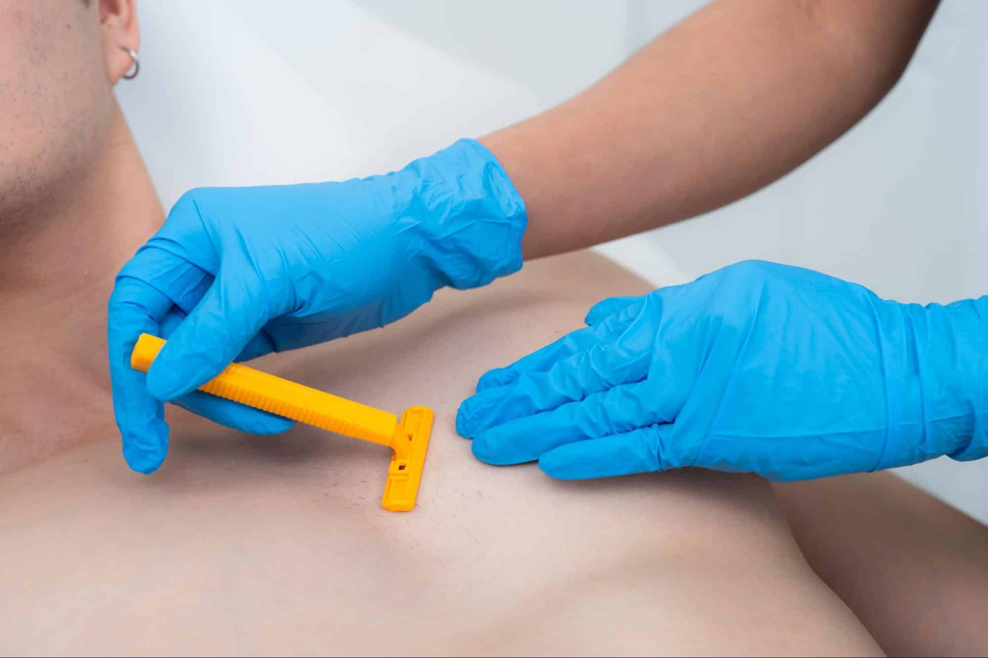 โกนขนก่อนเลเซอร์ขนหน้าอก