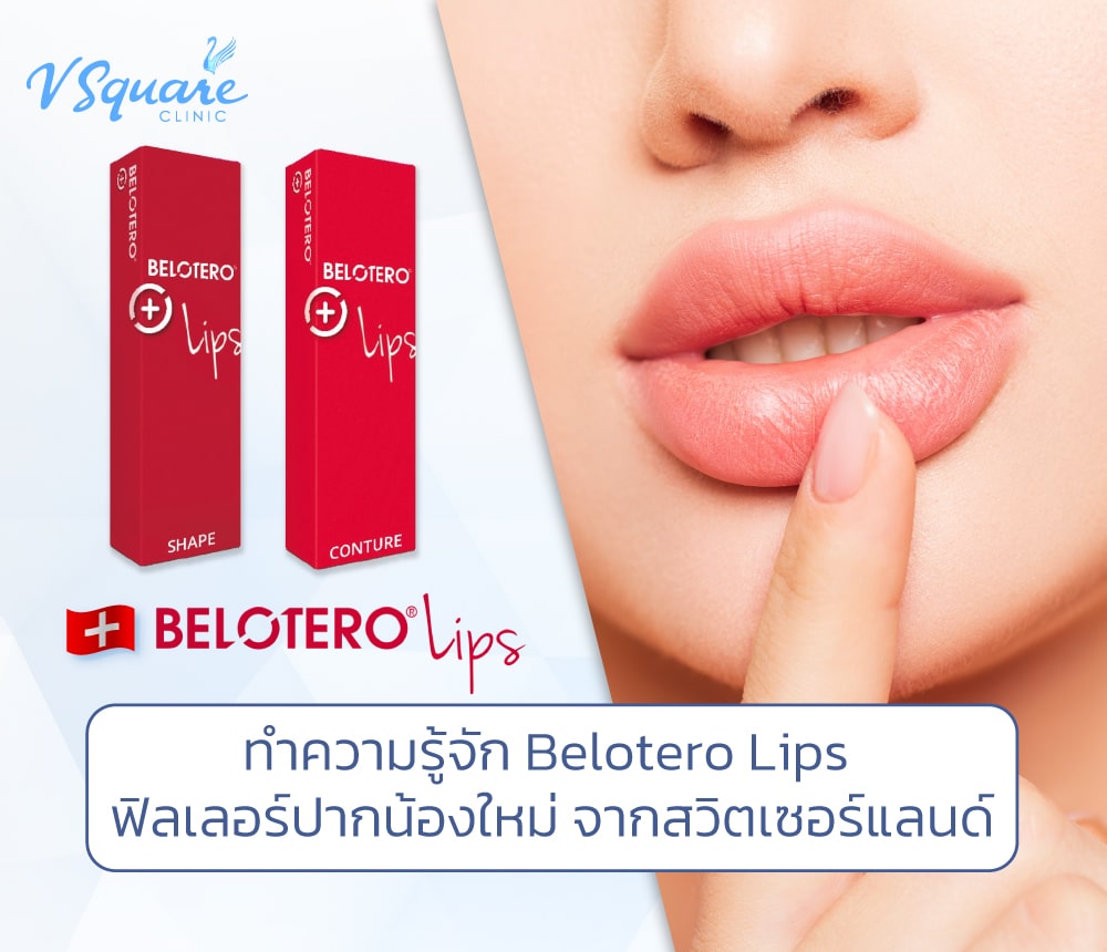 Belotero Lips