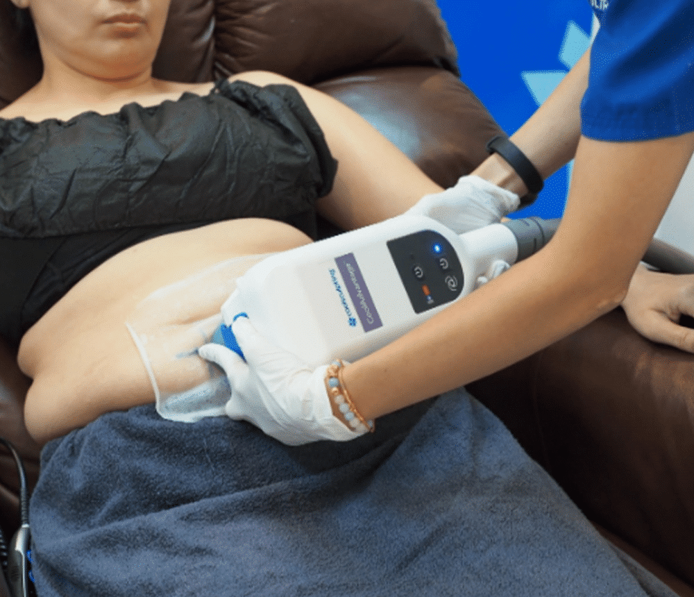 กำจัดไขมันเฉพาะจุดด้วย Coolsculpting