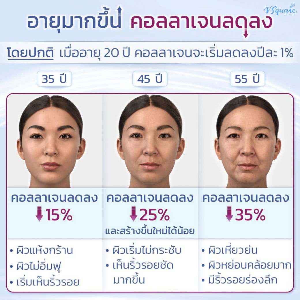 ถ้าร่างกายขาดคอลลาเจน