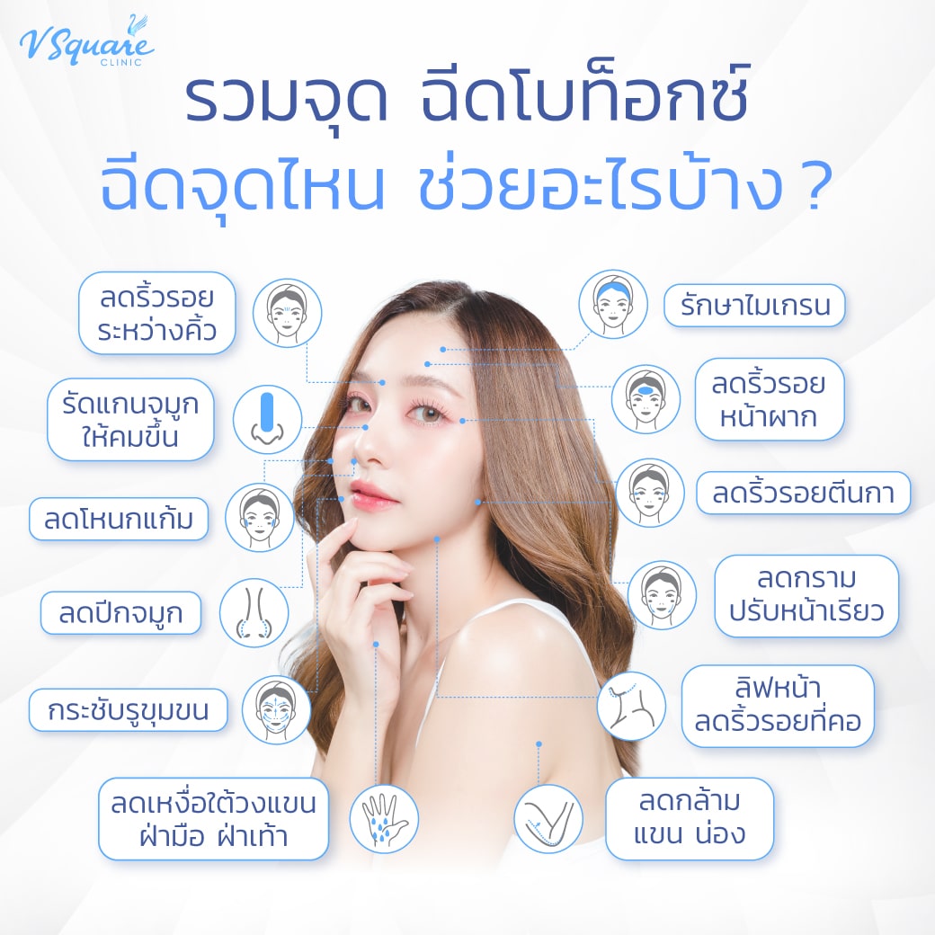 รวมจุดฉีดโบท็อก ฉีดตรงไหน