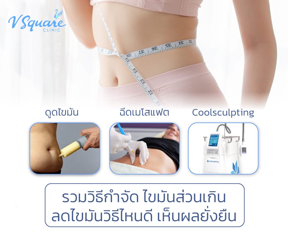 ไขมันส่วนเกิน