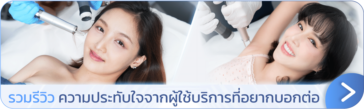 banner รีวิวเลเซอร์ขน