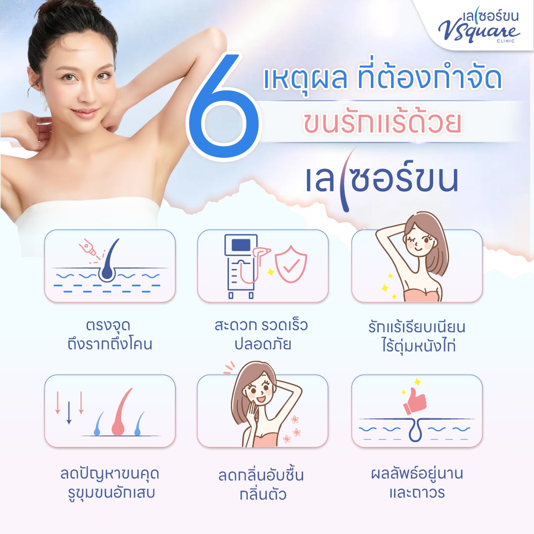 ข้อดี เลเซอร์ขนรักแร้