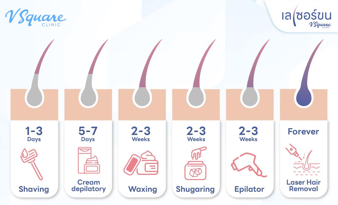 วิธีการกำจัดขนแคม อื่น ๆ นอกจากเลเซอร์