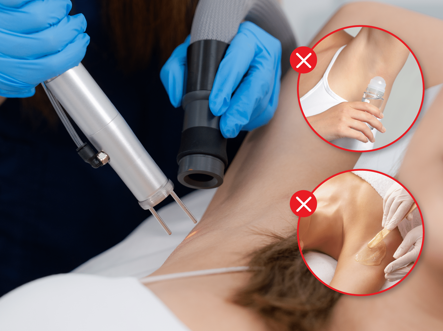 หลังเลเซอร์รักแร้ 370x277