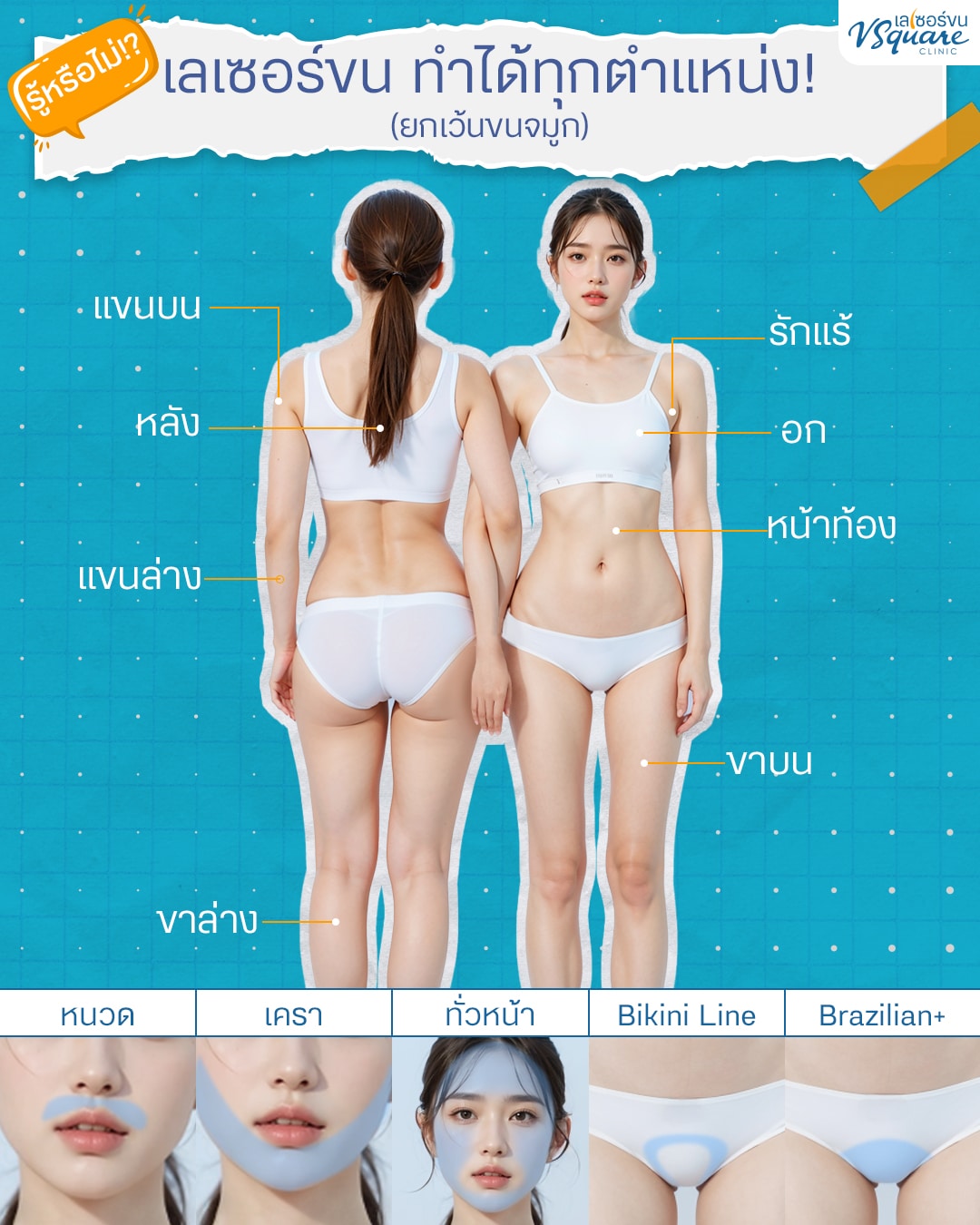 เลเซอร์ขนทั้งตัว ทำบริเวณไหนได้บ้าง