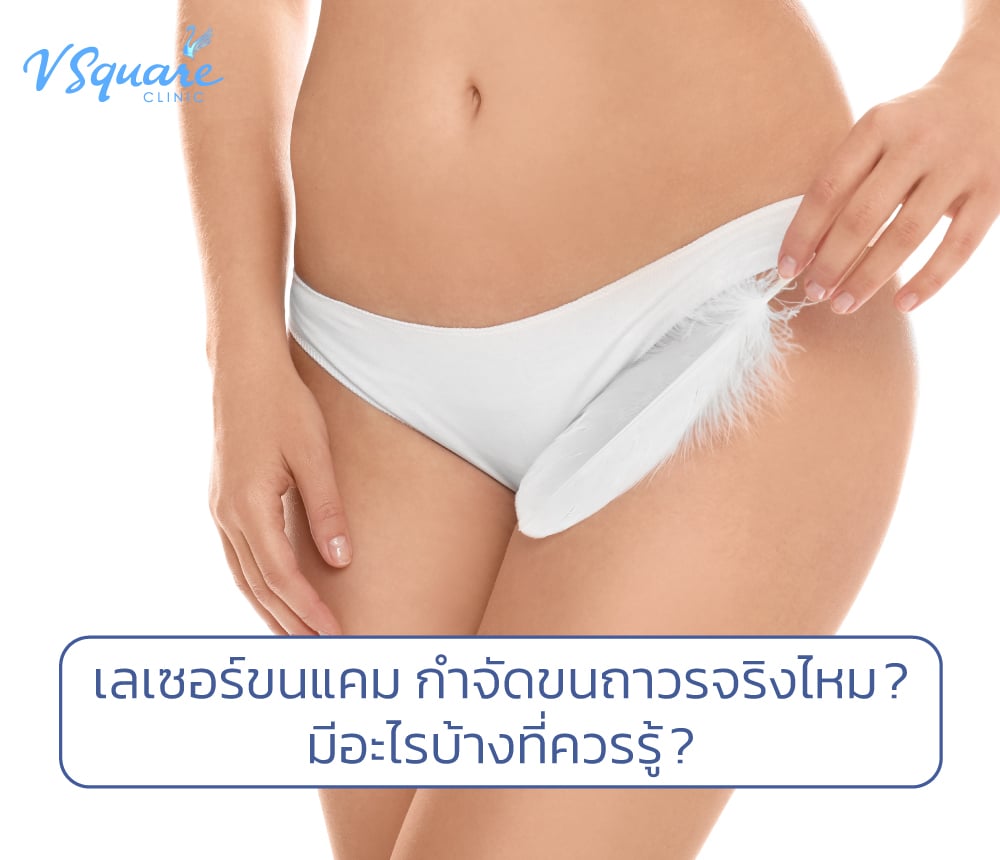 เลเซอร์ขนแคม