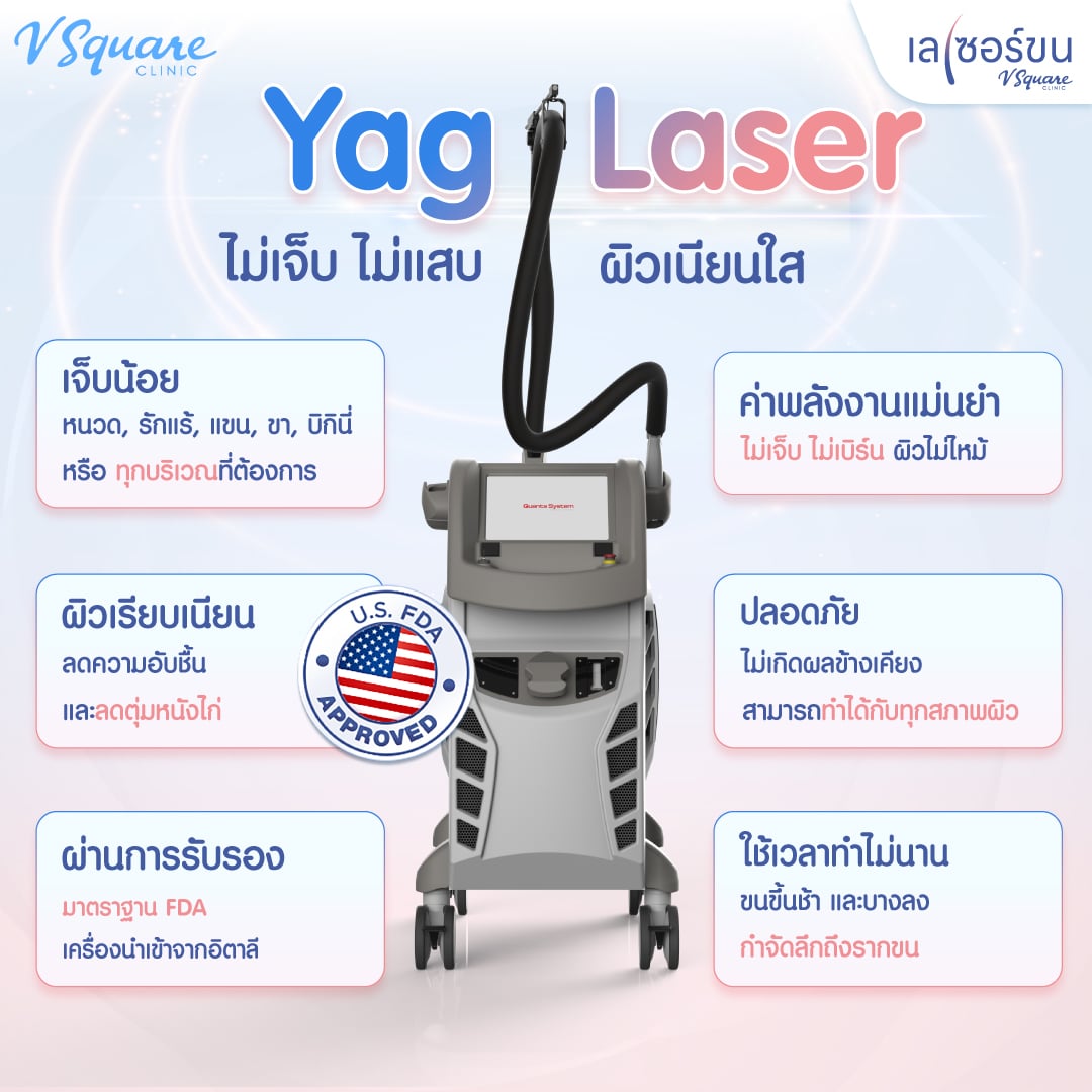 YAG Laser ข้อดี