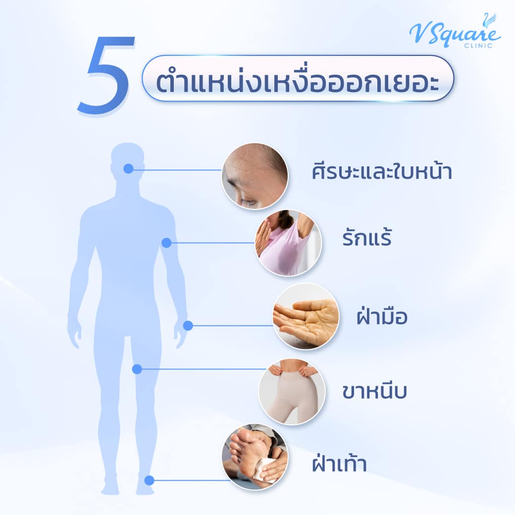 ตำแหน่งที่เหงื่อออกเยอะ