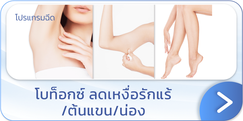 โบท็อกลดเหงื่อ