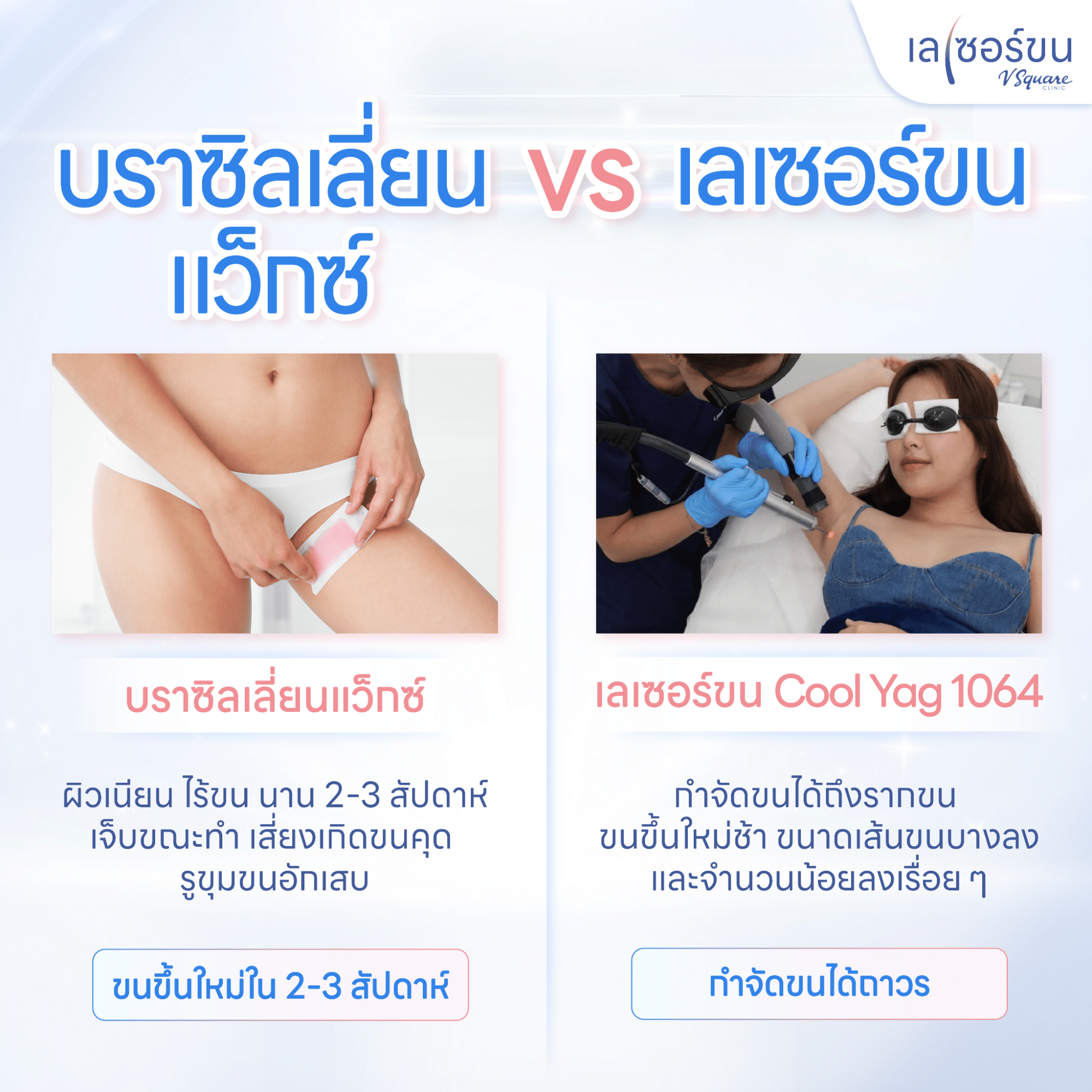 กำจัดขนวิธีไหนดี