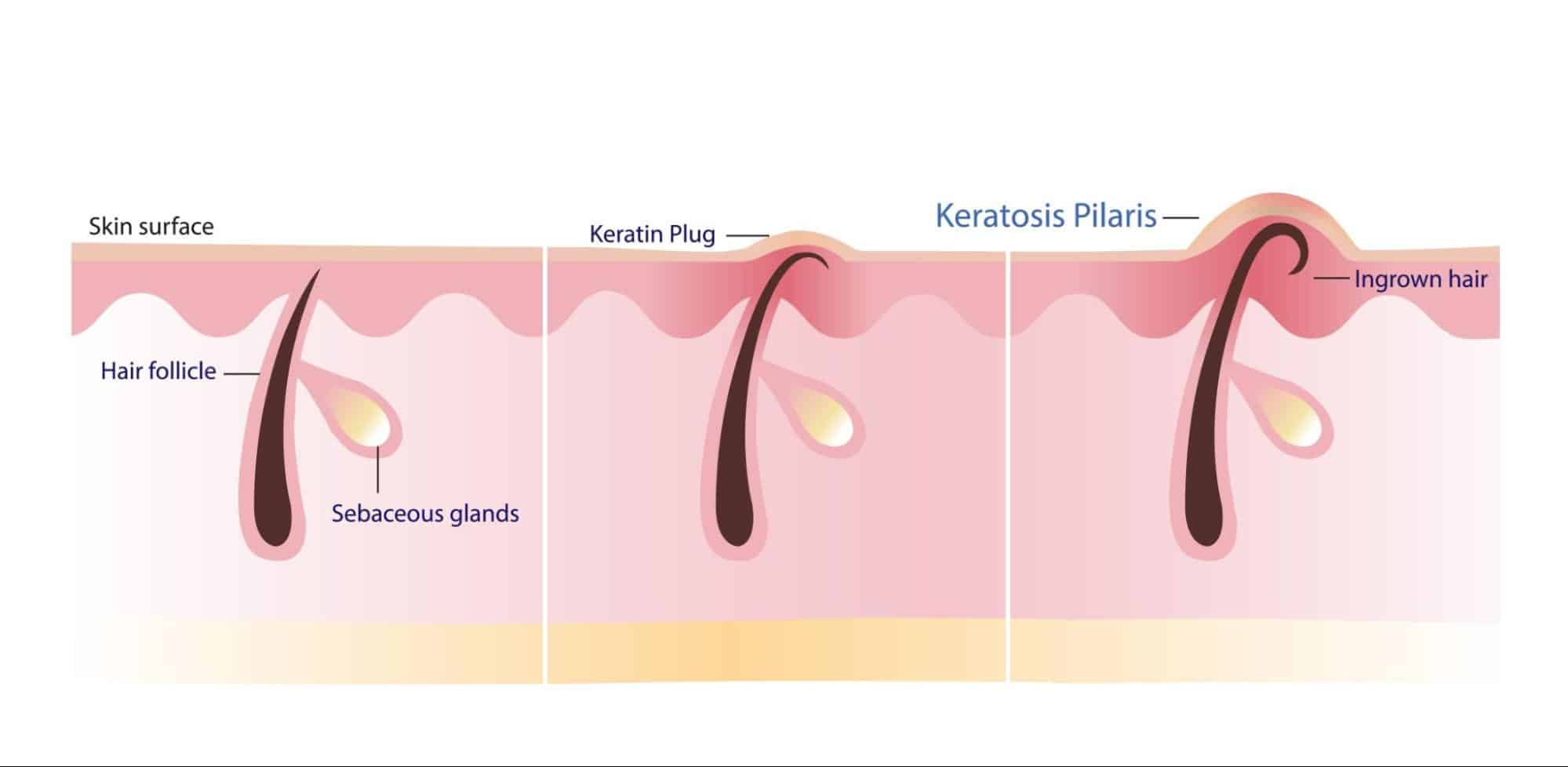 ขนคุดมีลักษณะอย่างไร