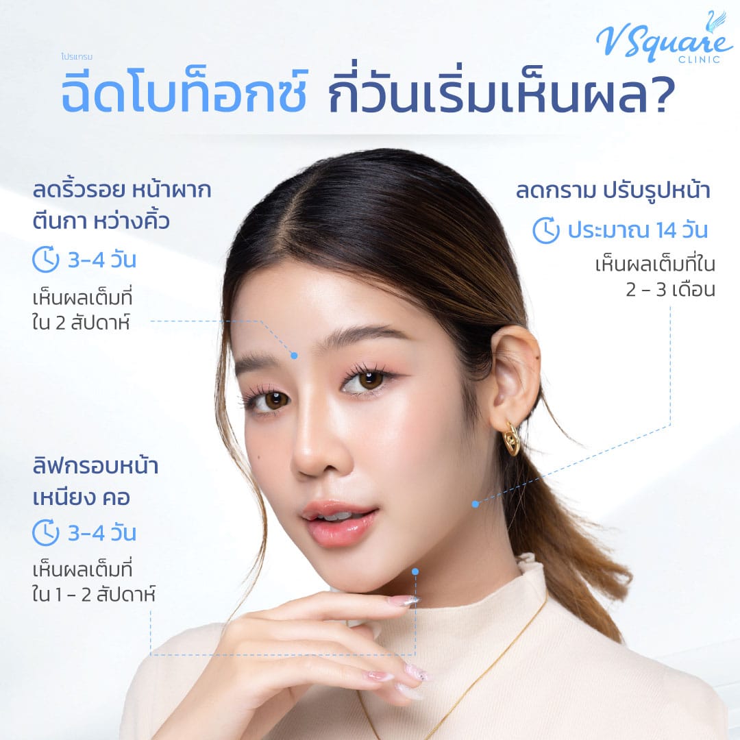 หลังฉีดโบท็อก Allergan กี่วันเห็นผล