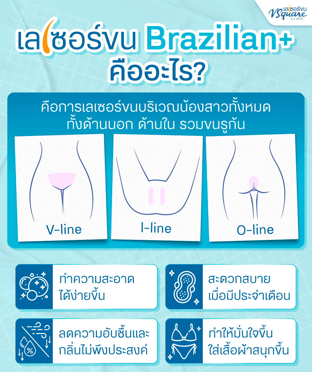 เลเซอร์บราซิลเลี่ยน คืออะไร