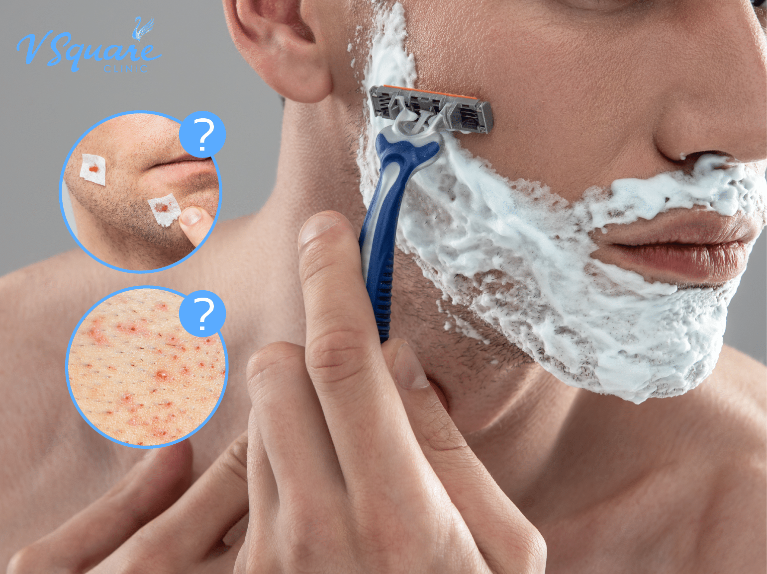 โกนหนวด 370x277