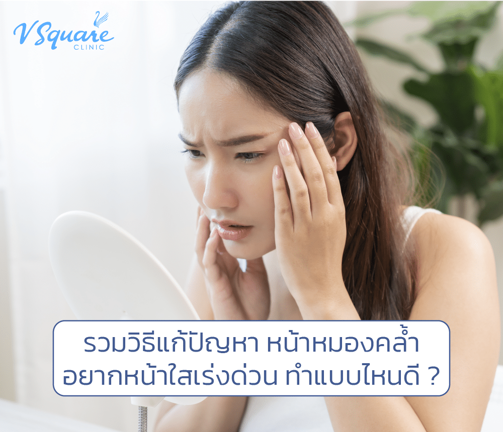 หน้าหมองคล้ำ