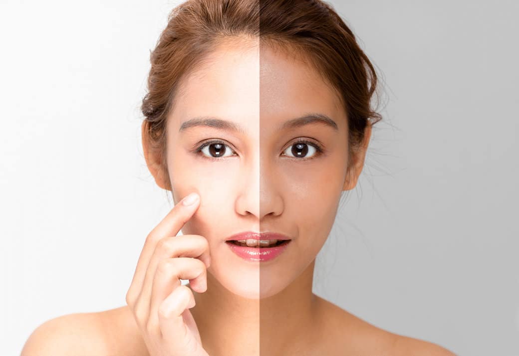 เฉดสีผิวหน้าหมองคล้ำ