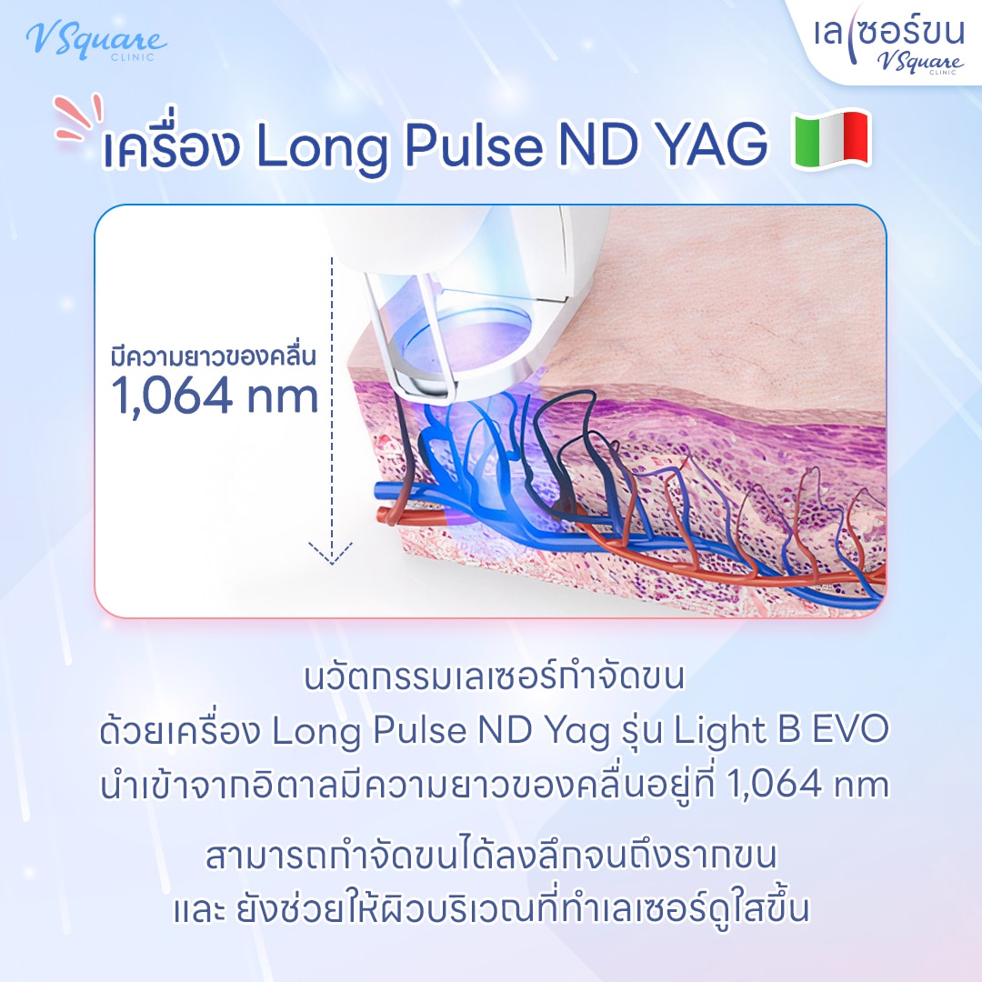การทำงานของ Laser ขนขา