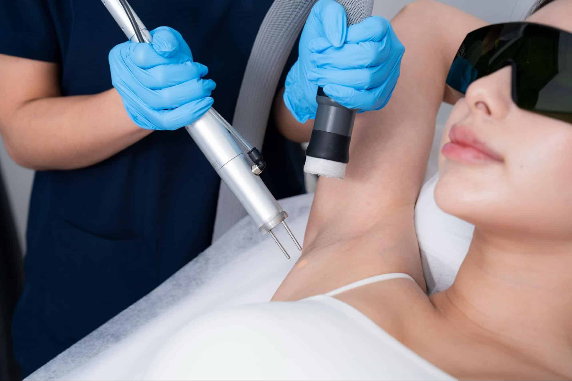 เลเซอร์ขนทำกี่ครั้งเห็นผล