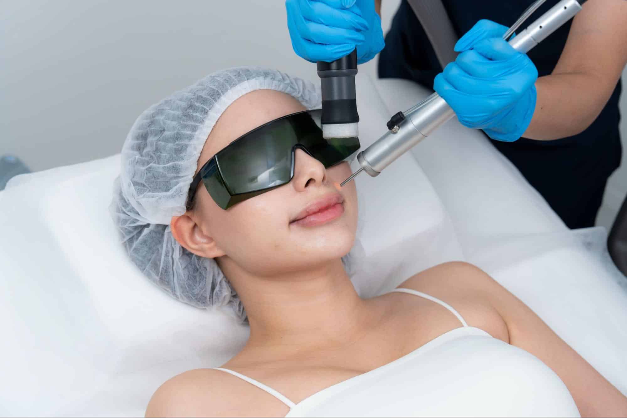 เลเซอร์หนวด ผู้หญิง