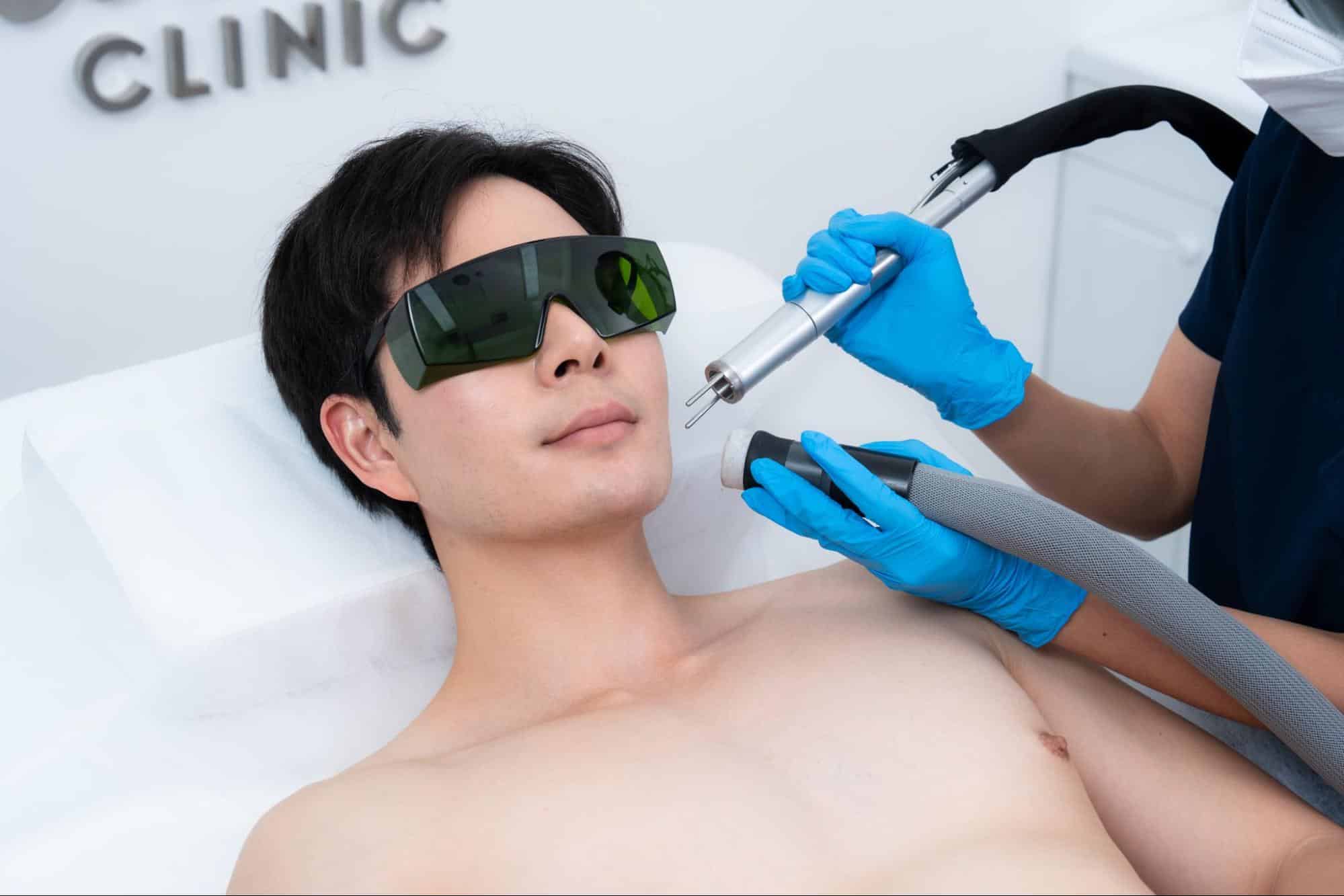 เลเซอร์หนวด เลเซอร์เครา