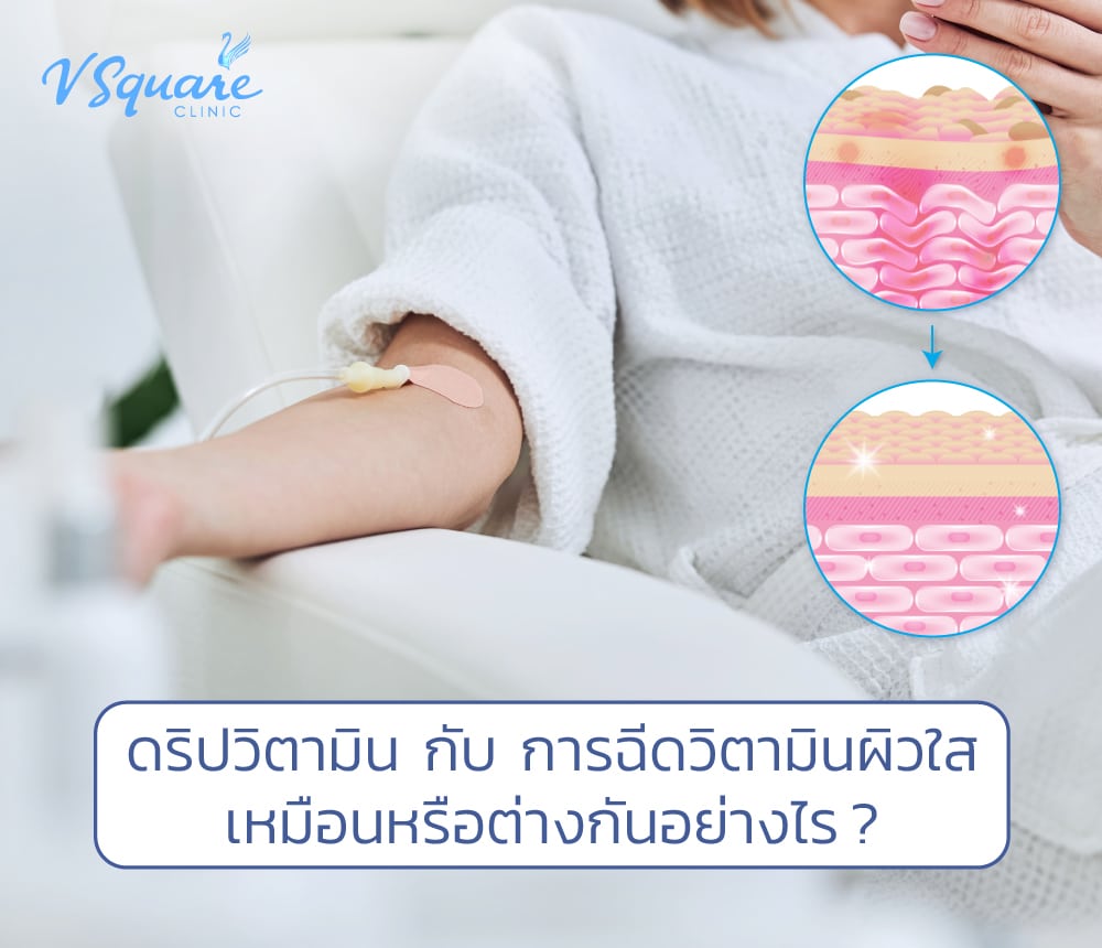 ดริปวิตามิน