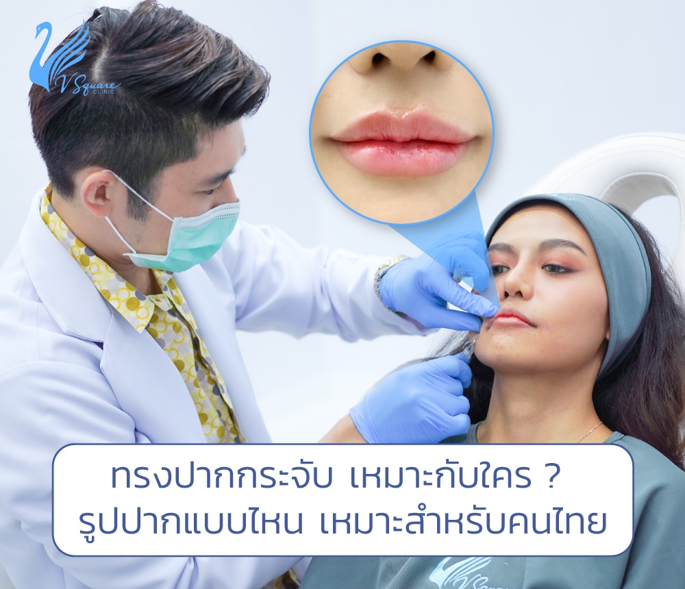 ทรงปากกระจับเหมาะกับใคร