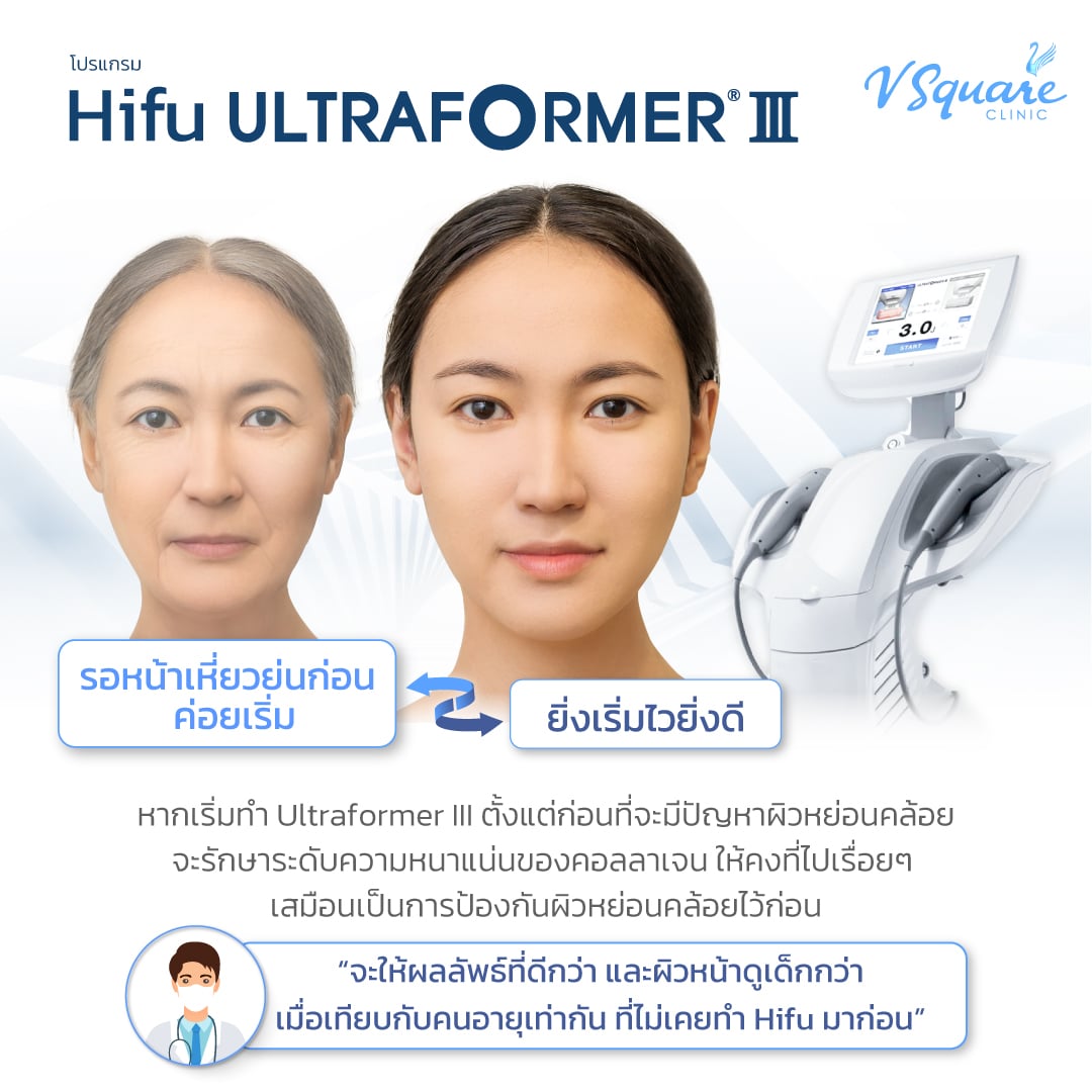 ทำ Ultraformer III ได้ตั้งแต่ตอนที่อายุน้อย
