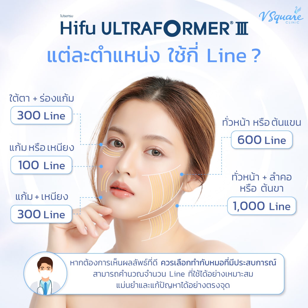 ทำ ultraformer iii ใช้กี่ไลน์