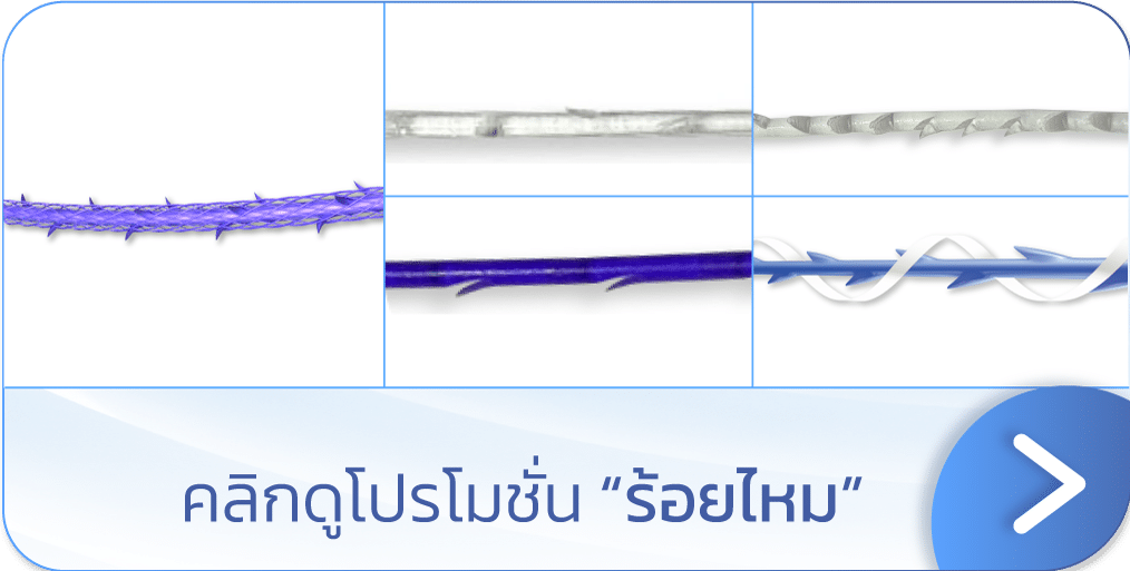 ร้อยไหม ราคา