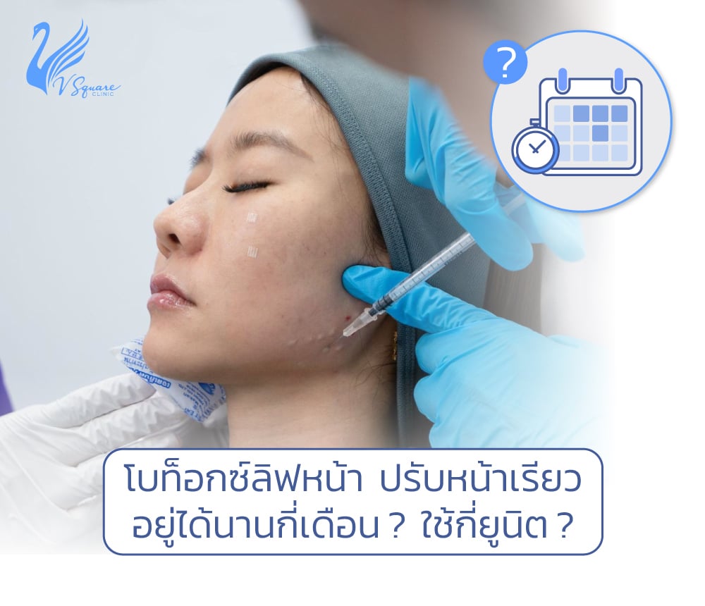 โบท็อกลิฟกรอปหน้า