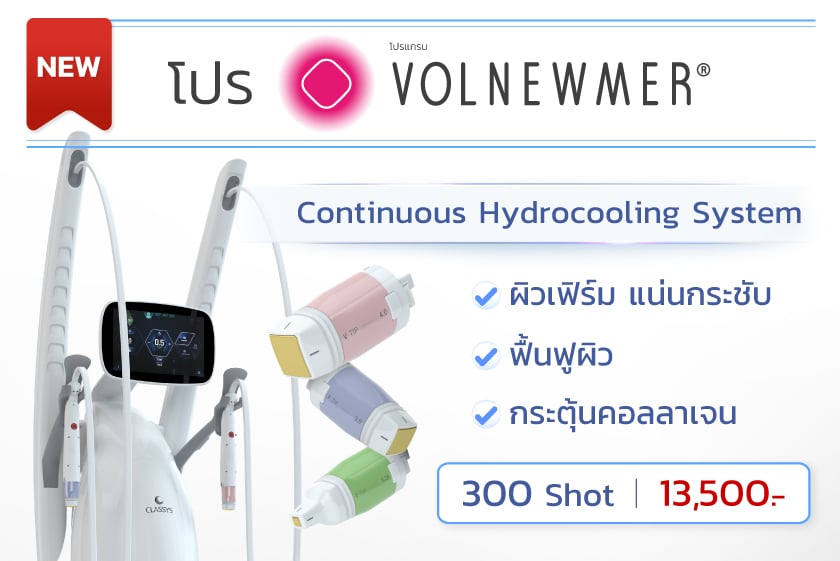 Landingpage_volnewmer_30MAY25