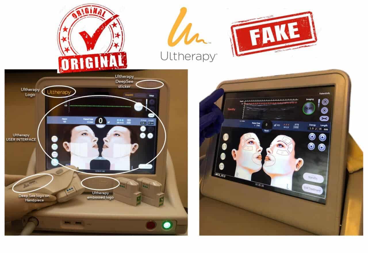 Ulthera ปลอมหน้าบวมนานอันตราย